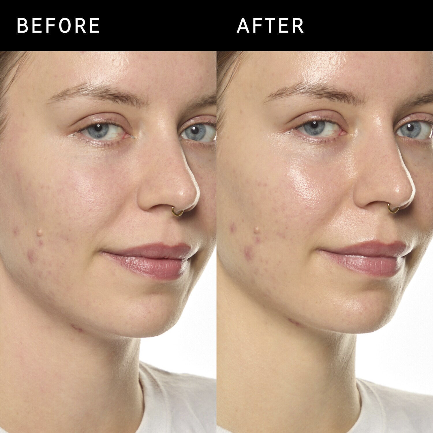 Ectoin Hydro-Barrier Serum - Fugtende og beskyttende serum