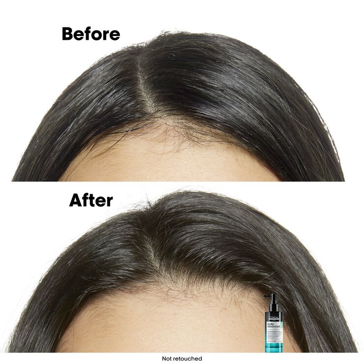 L'Oréal Professionnel Scalp Advanced Anti-Discomfort Shampoo 500ml