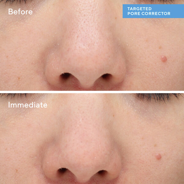 Targeted PoreCorrector 15 ml