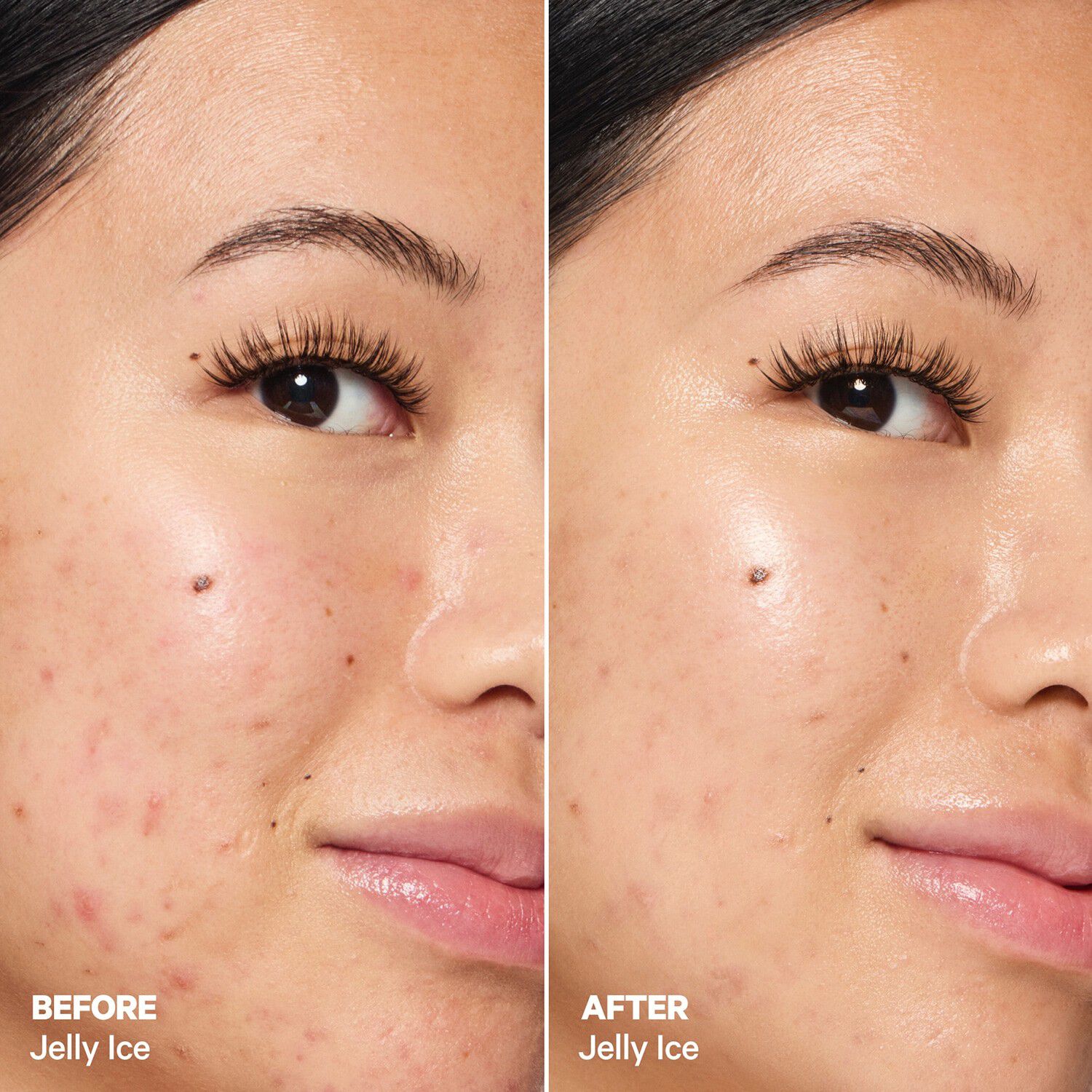 Cooling Water Jelly Ice - beroligende og forfriskende med niacinamid\t