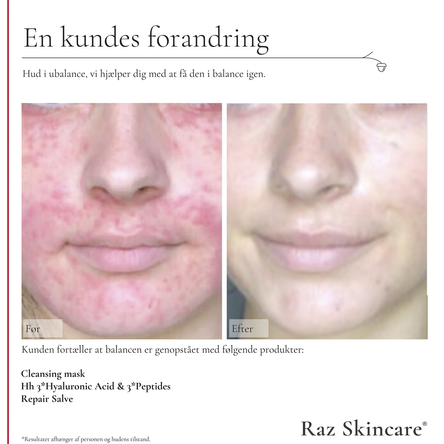 Raz Skincare Hh 3*Hyaluronic Acid & 3*Peptides 30 ml