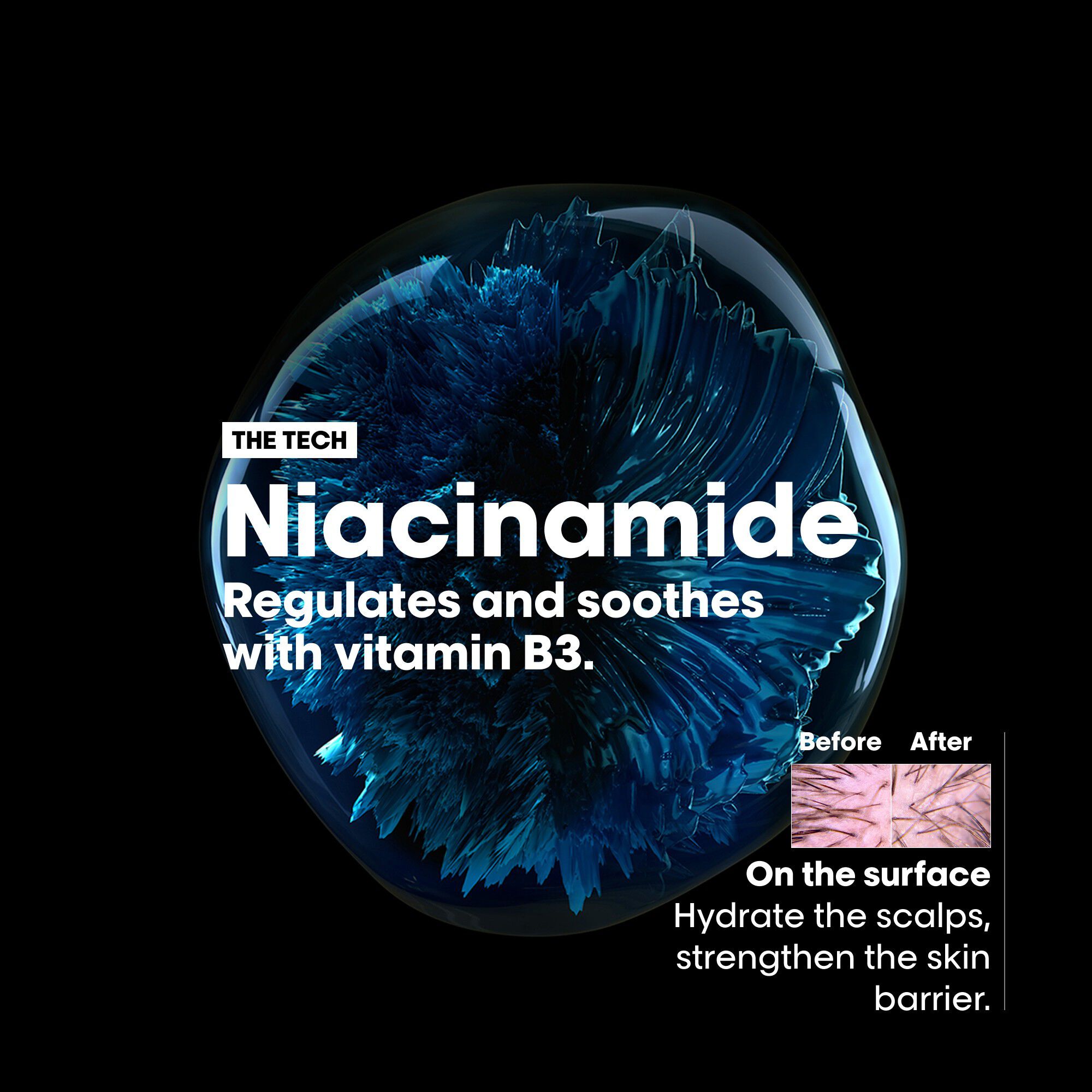 L'Or&eacute;al Professionnel Scalp Advanced Anti-Dandruff Shampoo 300ml