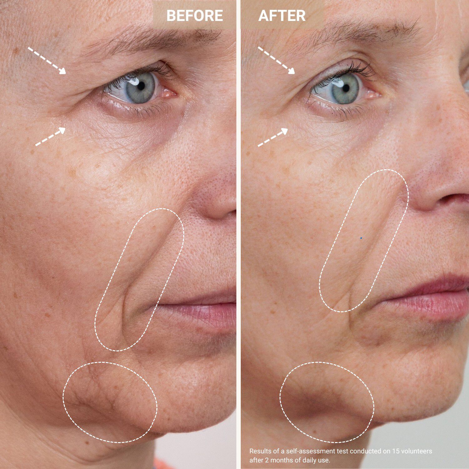 Youth Serum - Anti-aging serum med kobberpeptider