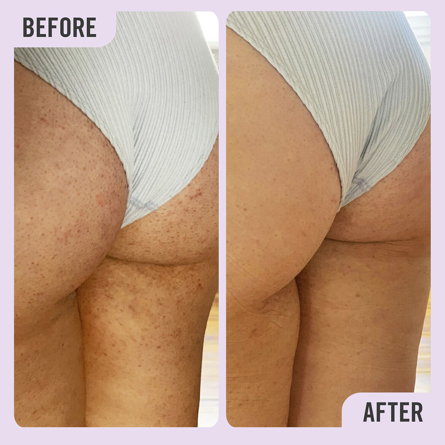 DAILY ESSENTIALS KP BODY SCRUB 10%