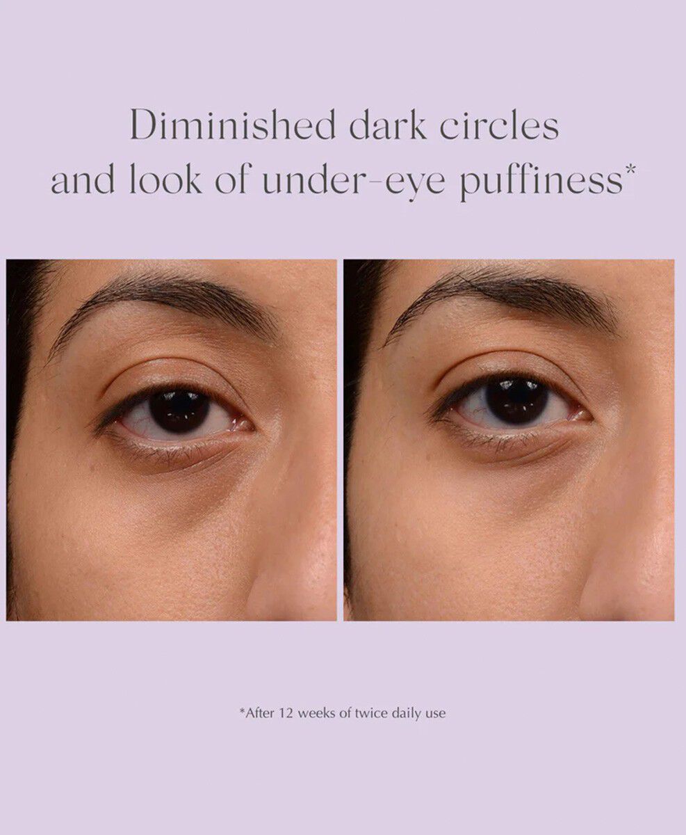 Bright Eyes Dark Circle Corrector