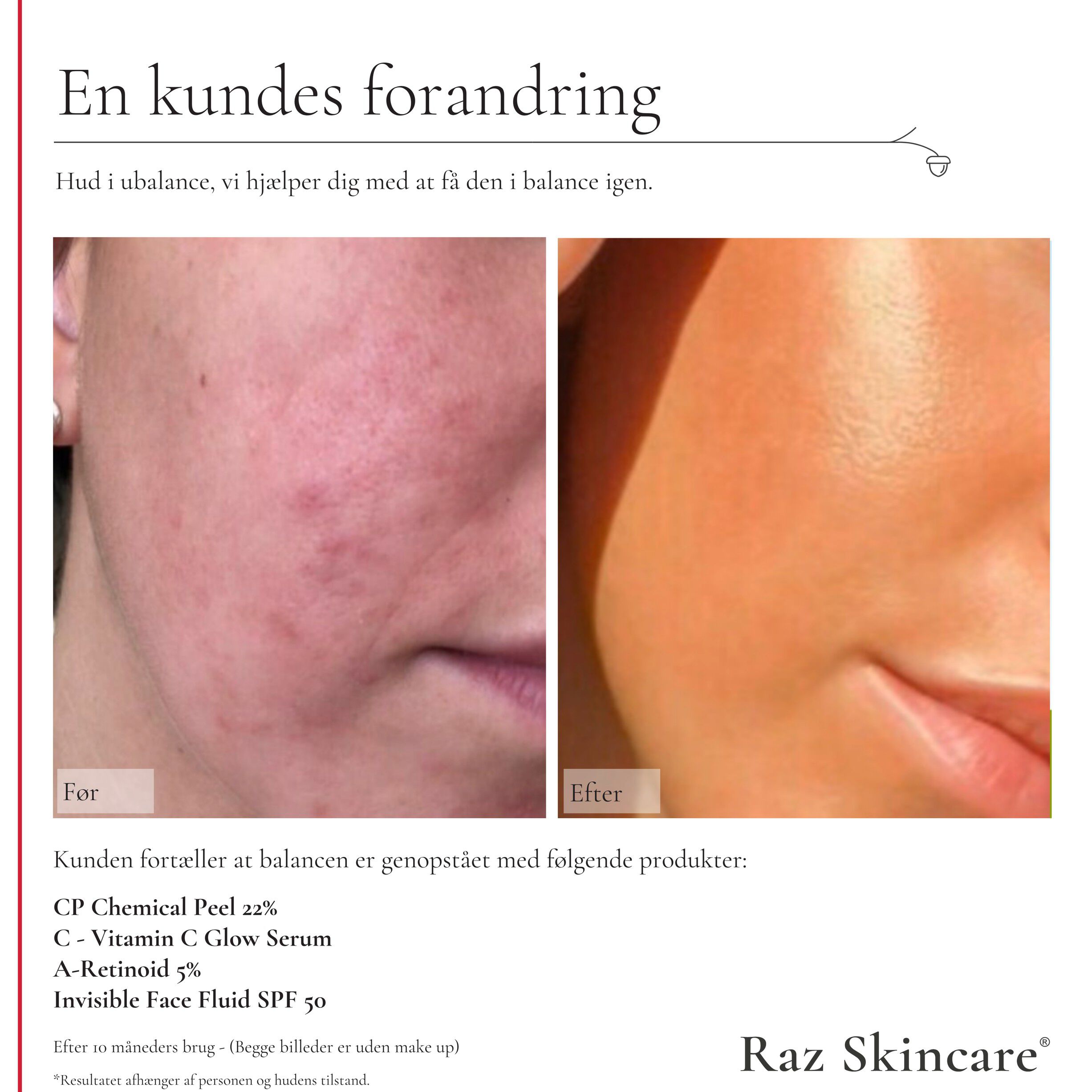 Raz Skincare C - Vitamin C Glow Serum 30 ml