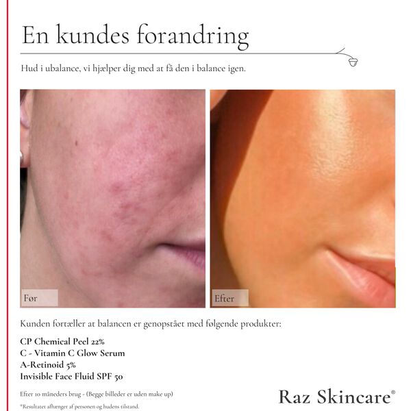 Raz Skincare C - Vitamin C Glow Serum 30 ml