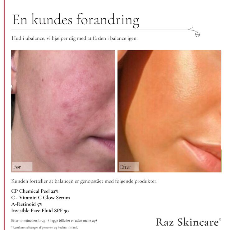 Raz Skincare C - Vitamin C Glow Serum 30 ml