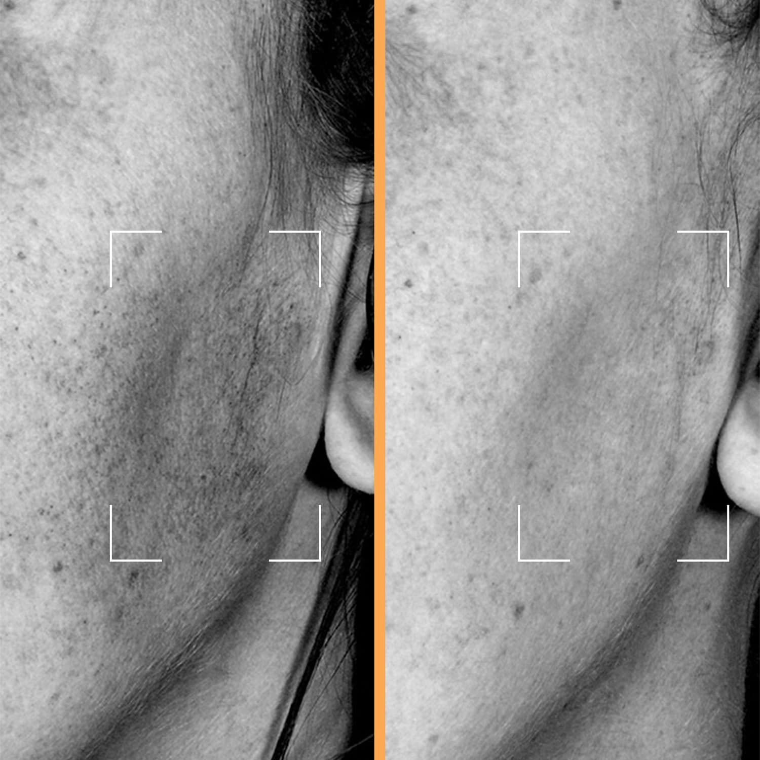 Brightening-kapsler - Glow-serum beriget med niacinamid og andrographi