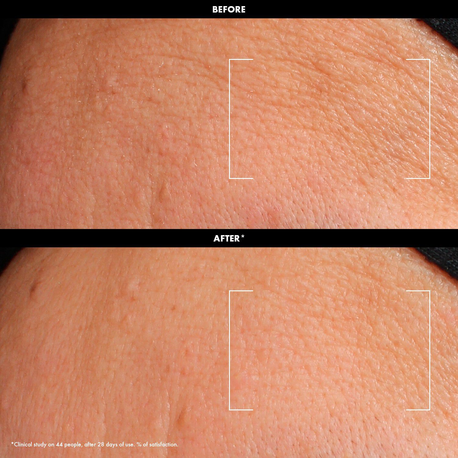 HYDRATE - Fugtende cremem&aelig;lk hyaluronsyre