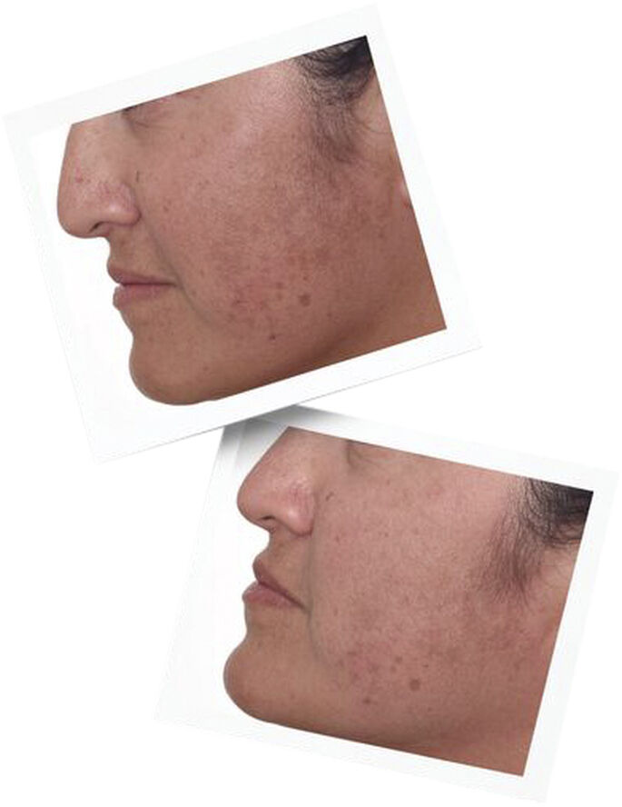 Rapid Dark Spot Correcting Serum