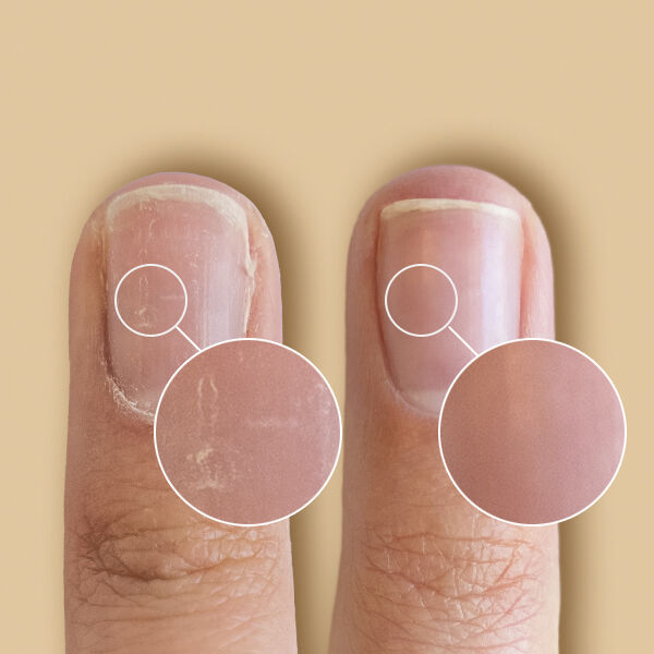 SolarOil Nail Care 7,38 ml