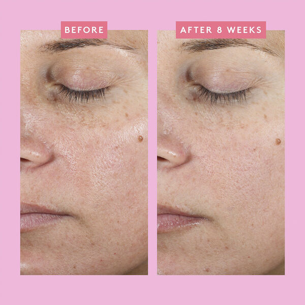 COLLECTION BORA BARRIER QUAD CREAM