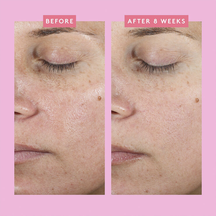 COLLECTION BORA BARRIER QUAD CREAM