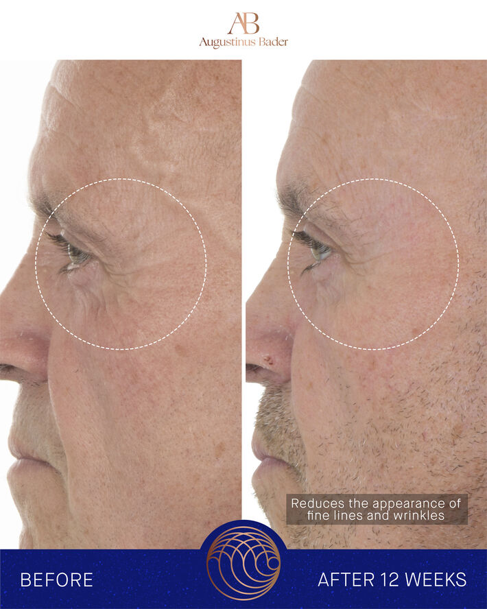 The Retinol Serum 15ml Nomade ROW