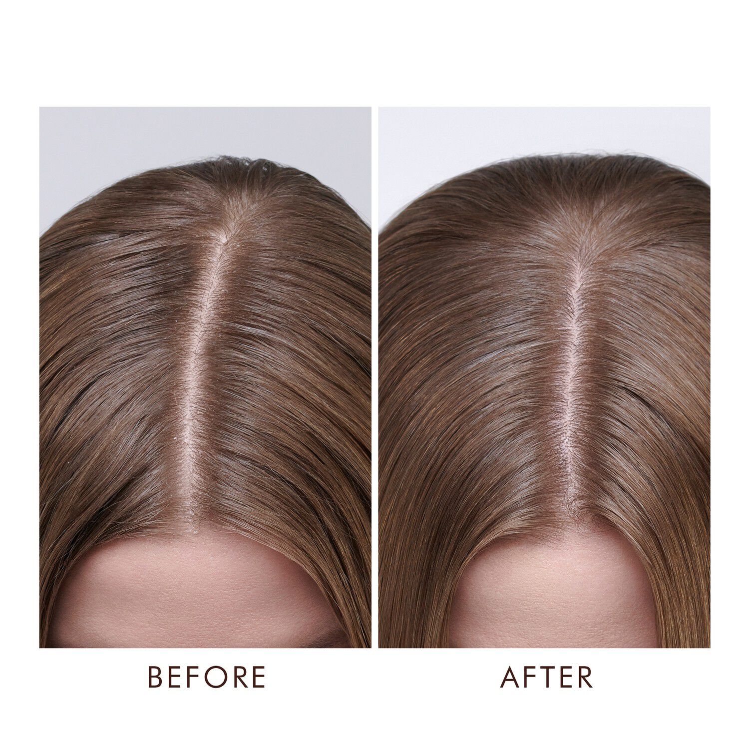 Dry Scalp Treatment, 45 ml.