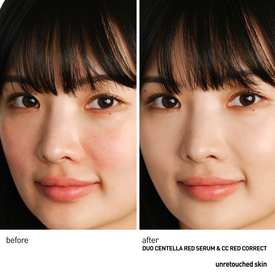 Centella Red Serum - &Oslash;jeblikkeligt beroligende koncentrat