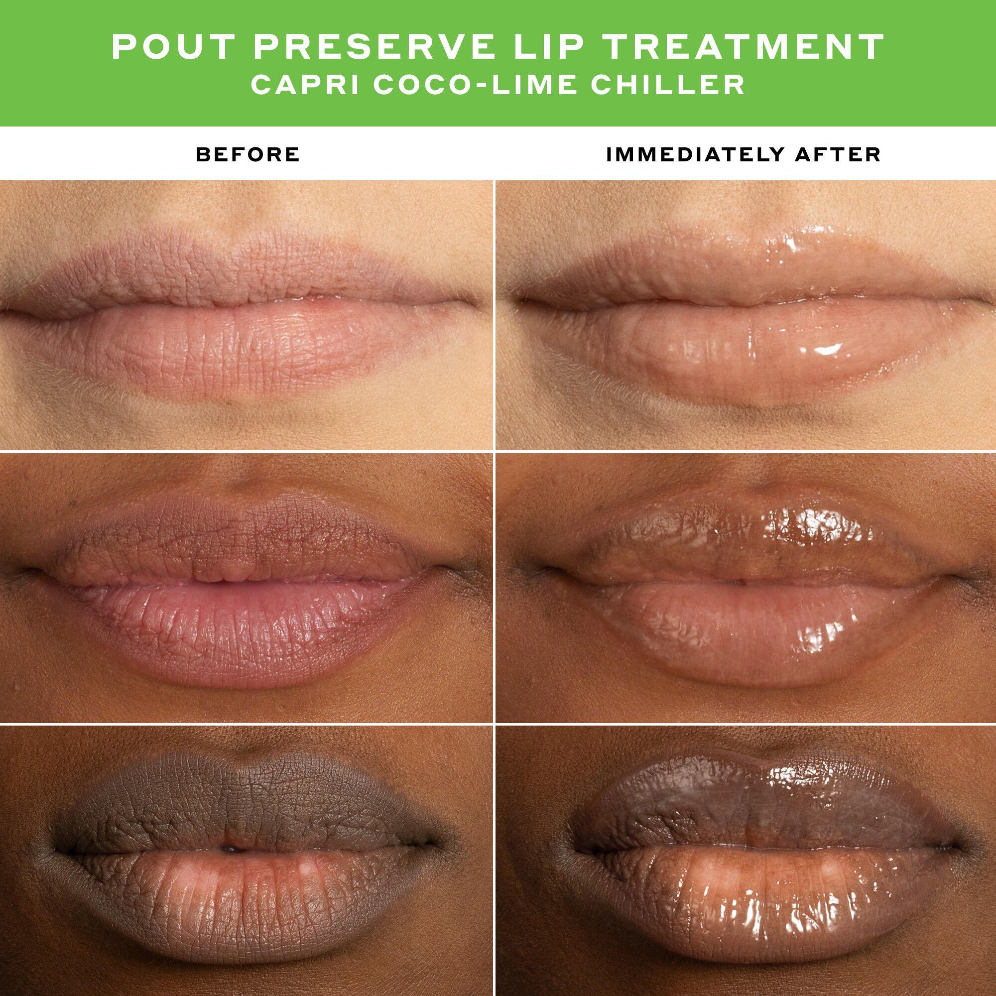 LIP TREATMENT