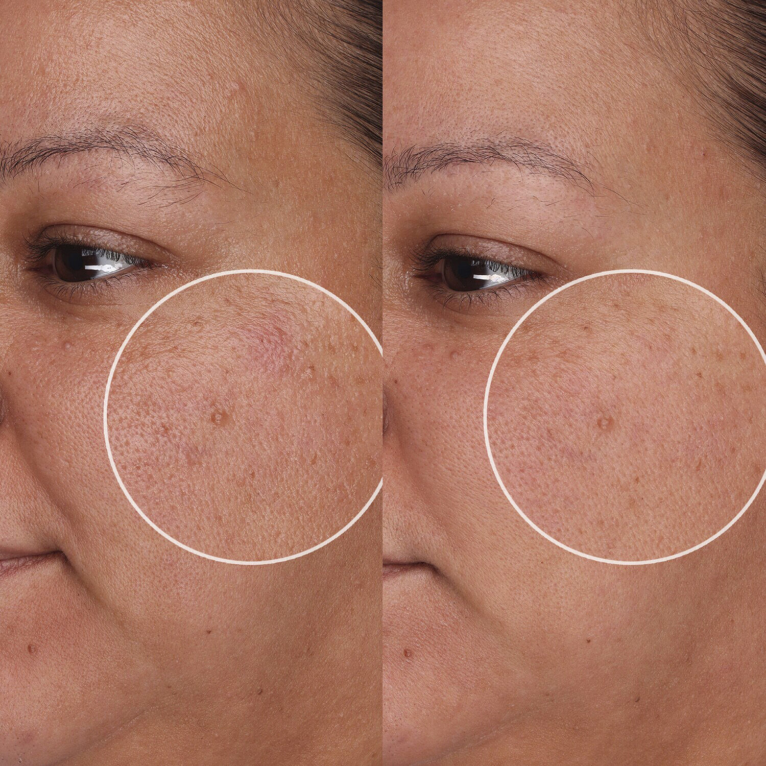 The POREfessional Wow Polish - Eksfolierende pudder til tilstoppede po