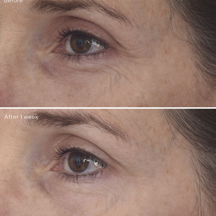 RETINAL RESCUPLT EYE TREATMENT 15 ML