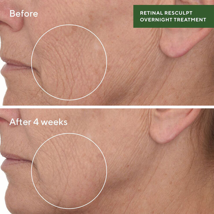 RETINAL RESCULPT OVERNIGHT TREATMEN