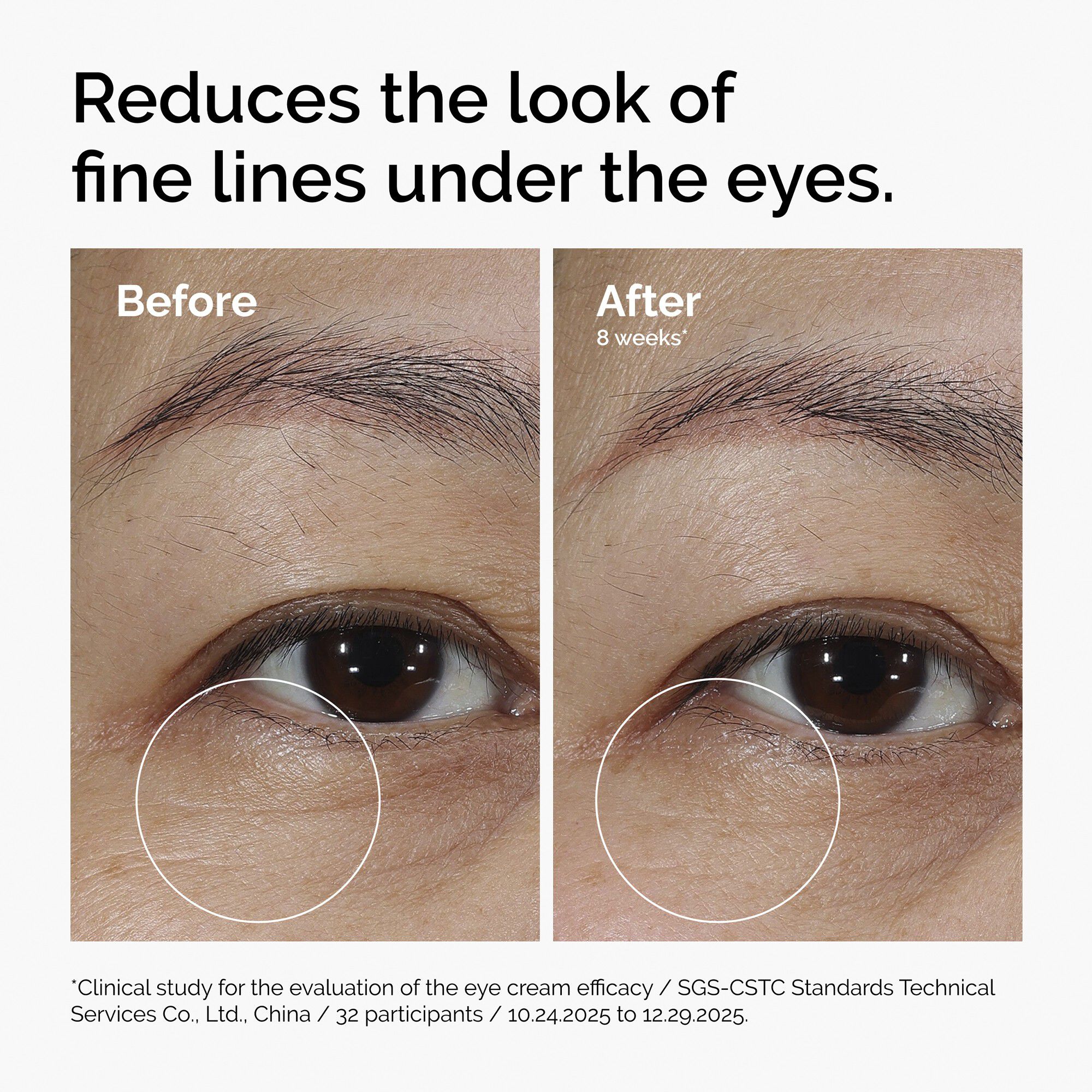 Lacto-PDRN* 4% +B9 Eye Cream