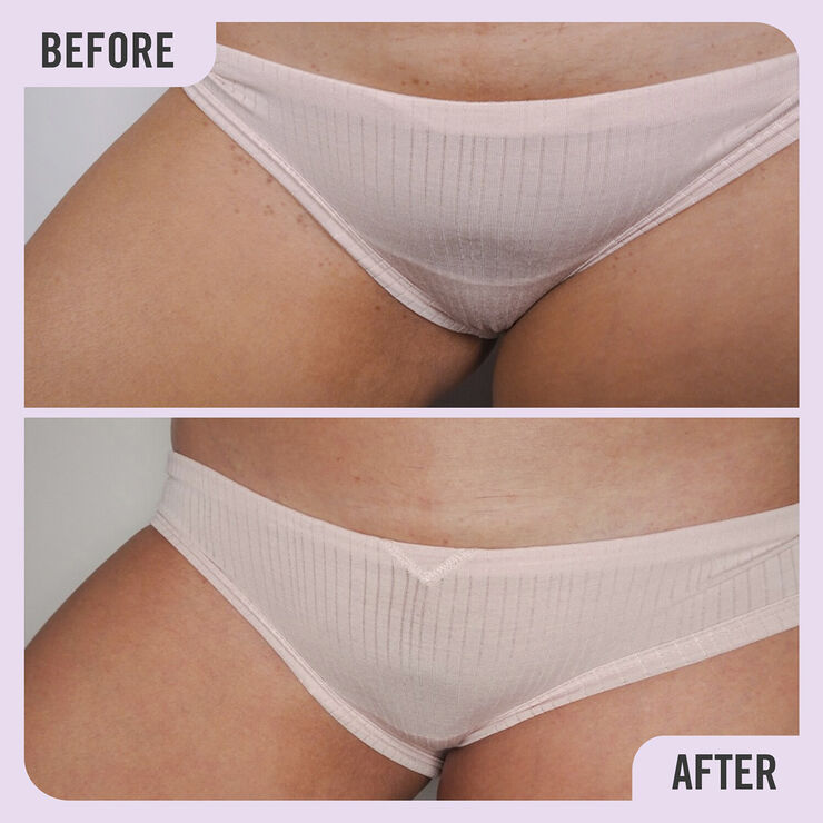 Ingrown Hair Pads with BHA & AHA