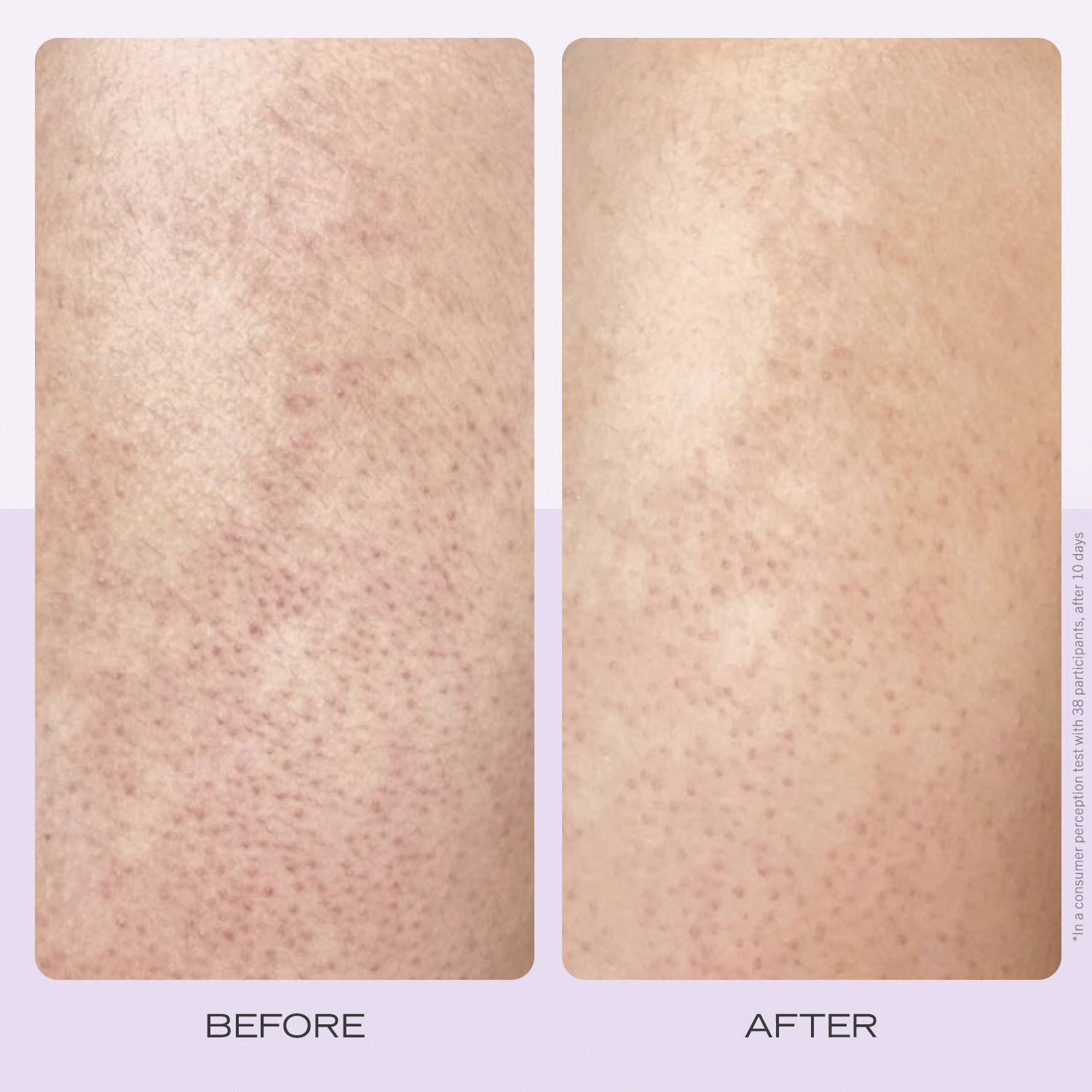 KP Body Scrub Strawberry - Bodyscrub med AHA Jordb&aelig;rduft Omg&aring;ende virk