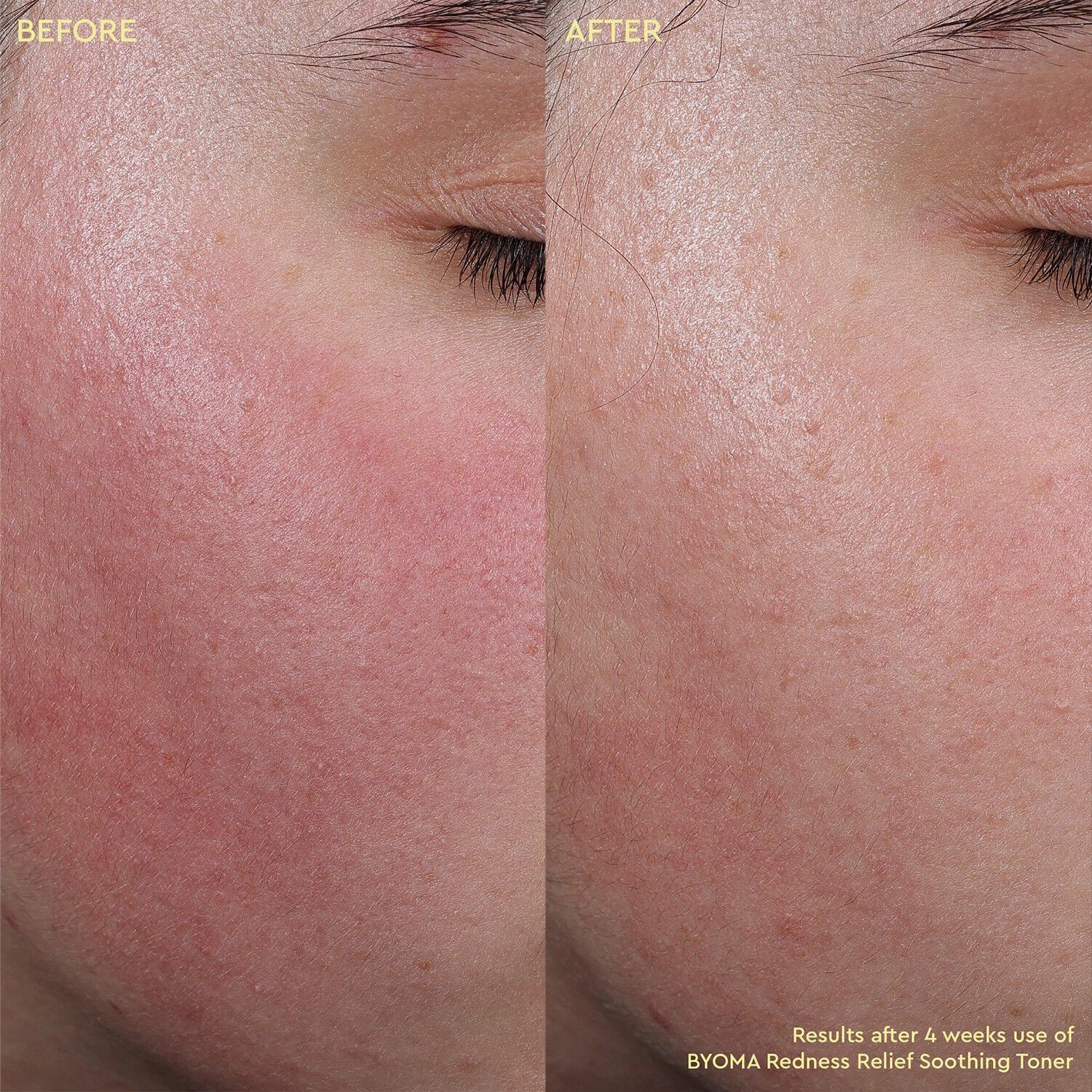 Redness Relief Soothing Toner - Beroligende toner mod r&oslash;dme