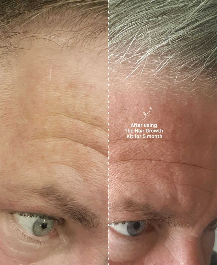 The Hair Growth Kit
