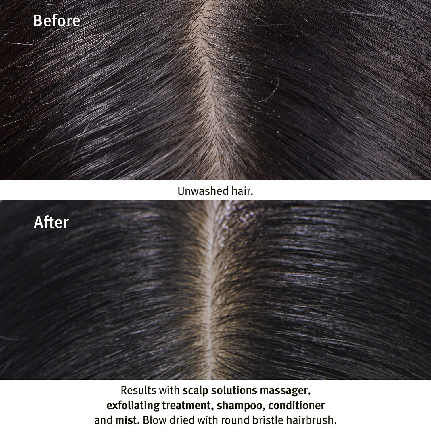 Scalp Solutions Stimulating Scalp Massager