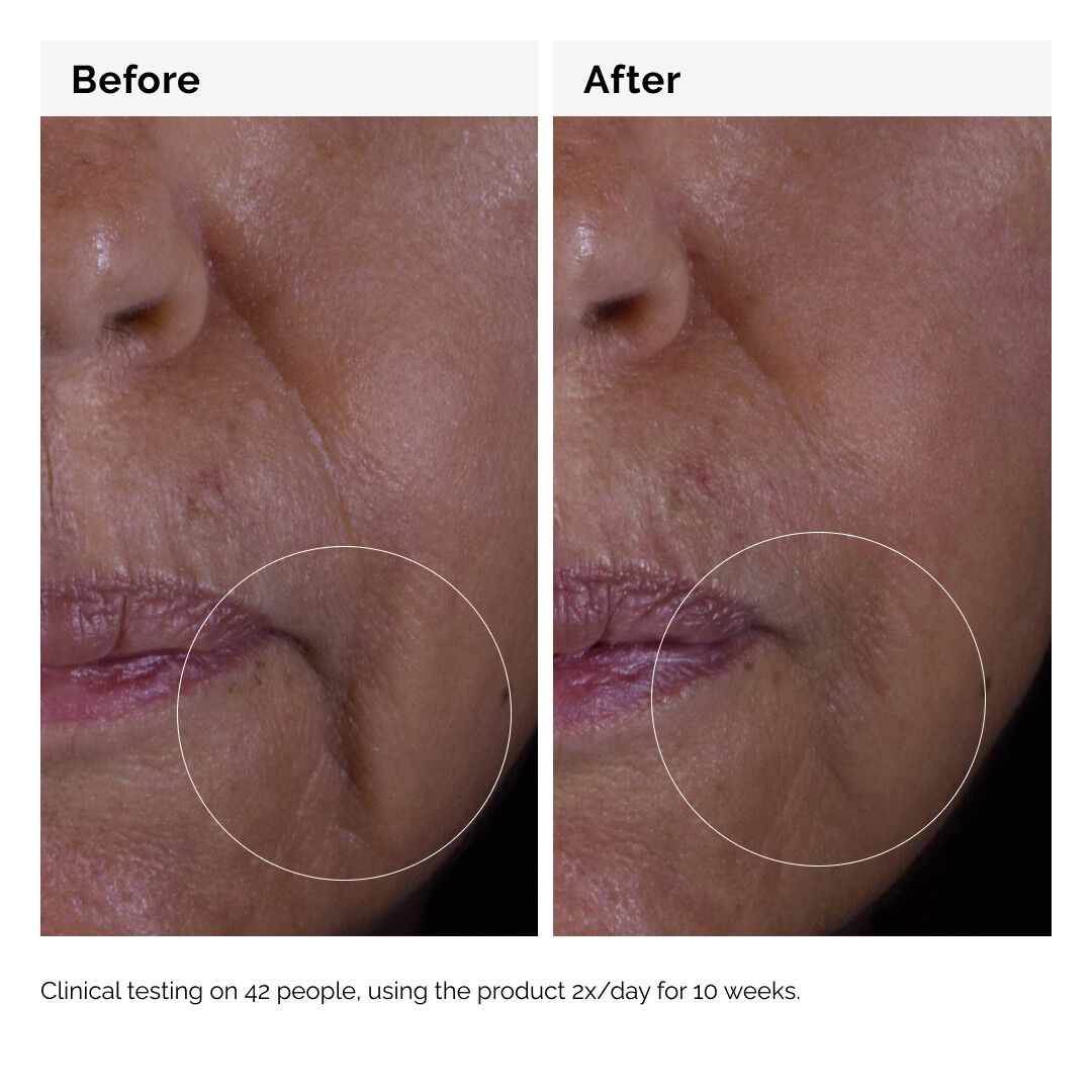 GF 15% Solution Serum