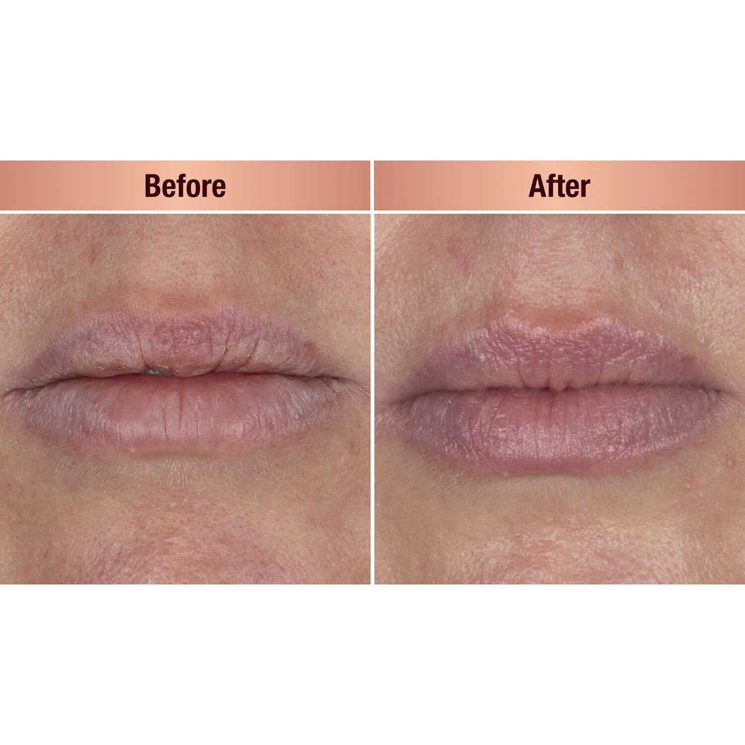 Life Changing Lip Mask  nattmask f&ouml;r l&auml;pparna