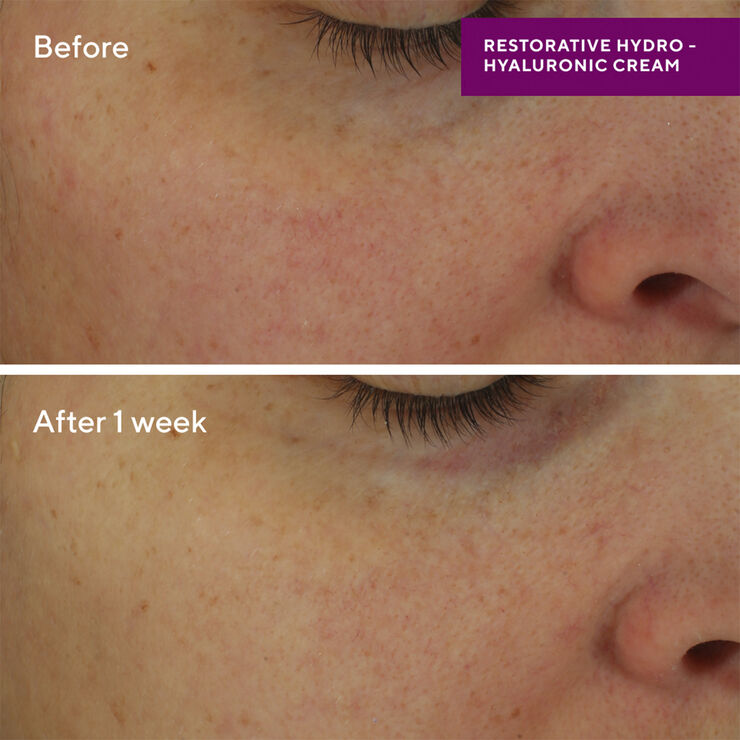 Restorative Hydro-Hyaluronic Cream