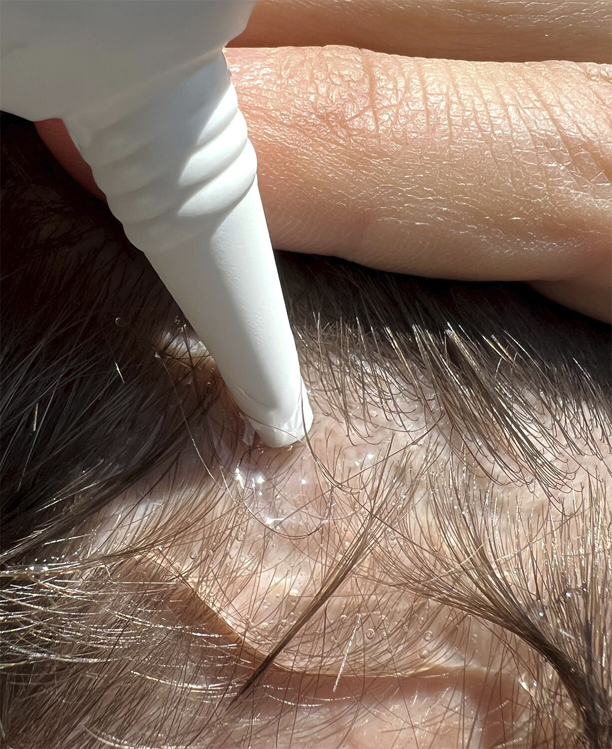 Hair Activator - H&aring;rstimulerende serum