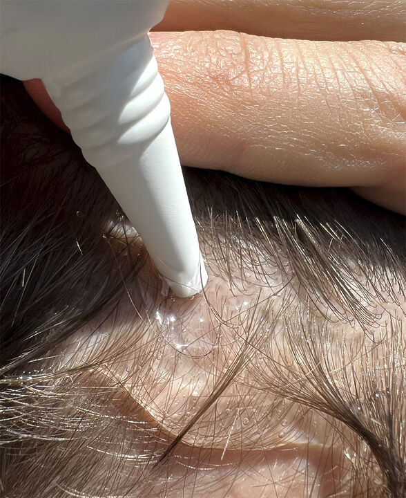 Hair Activator - Hårstimulerende serum