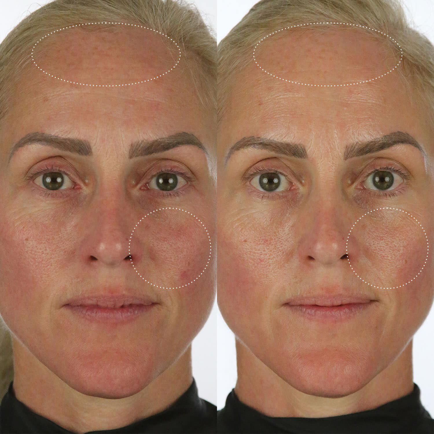 The Milky Sunscreen SPF 50 - Solbeskyttelse