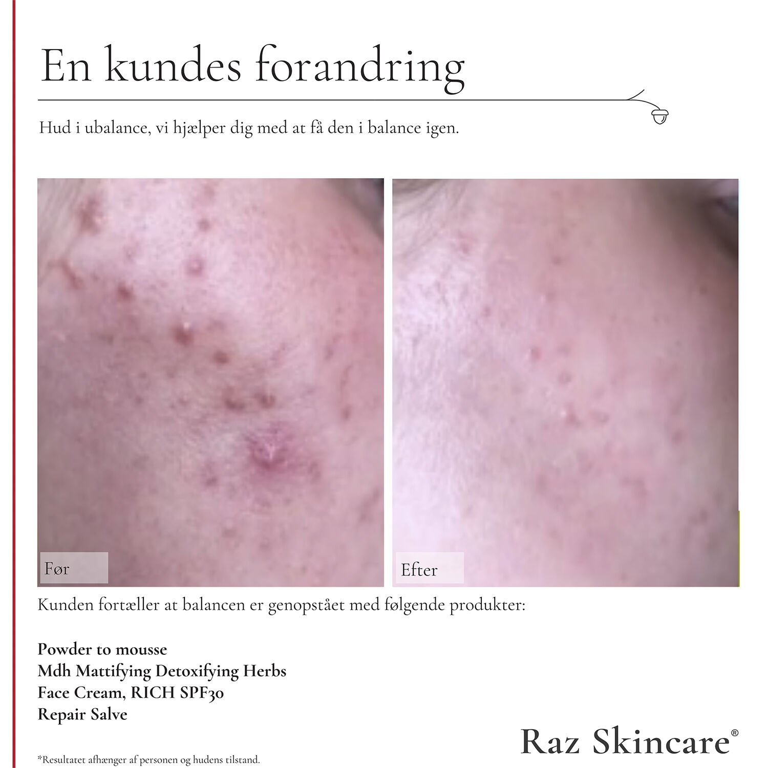 Raz Skincare Face Cream, RICH 50 ml