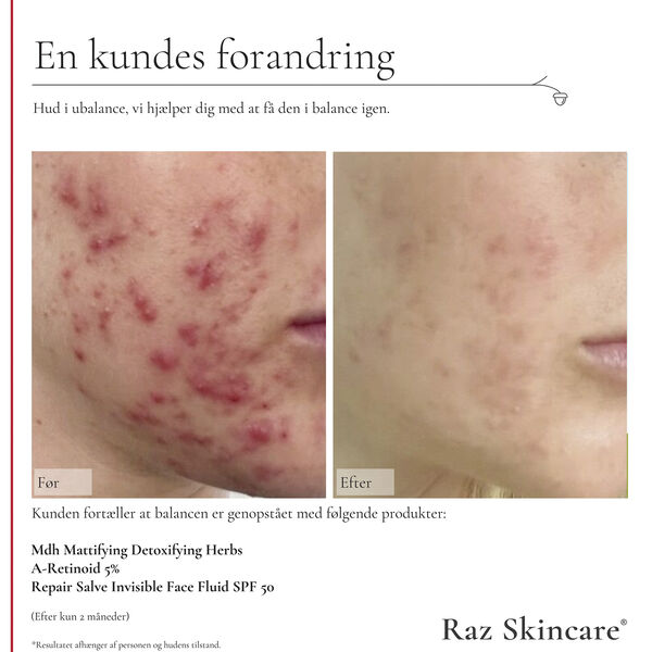 Raz Skincare A-Retinoid 5% 30 ml