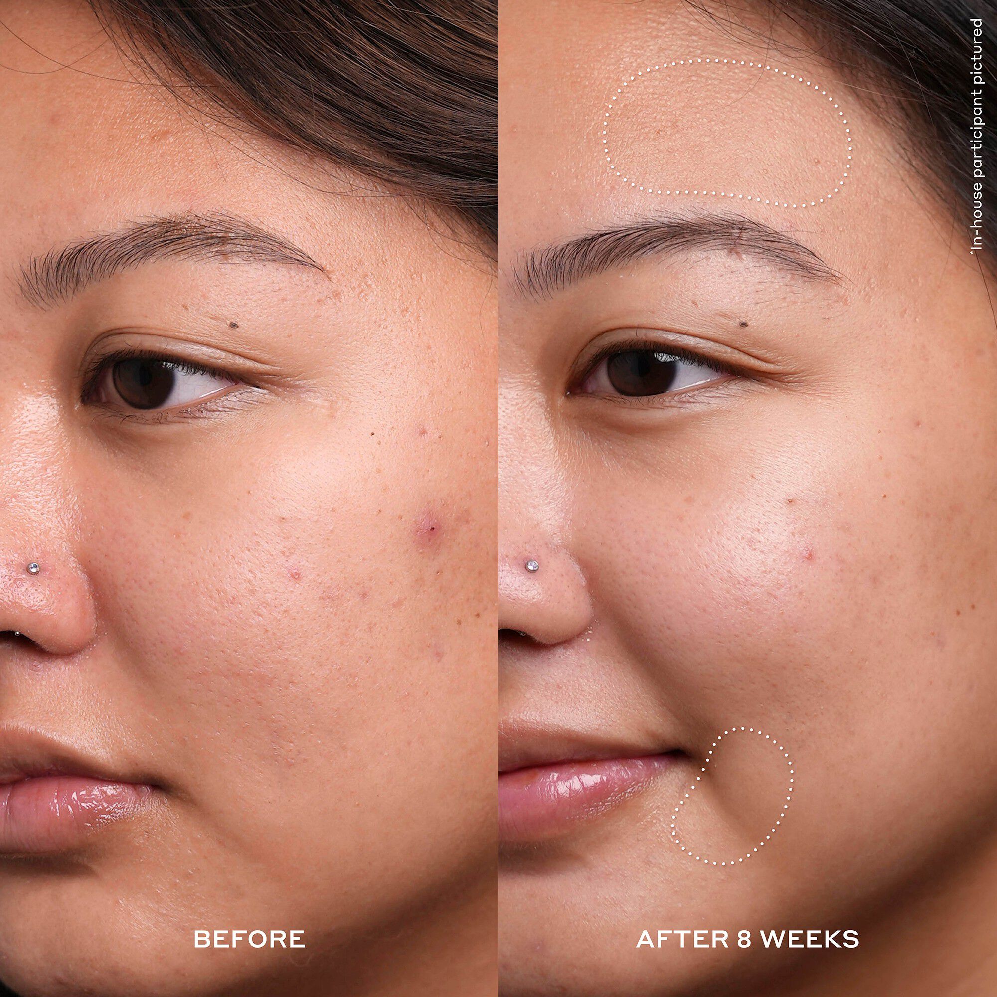 OLE HENRIKSEN TRANSFORM Dewtopia 20% Acid Treatment 30 ML