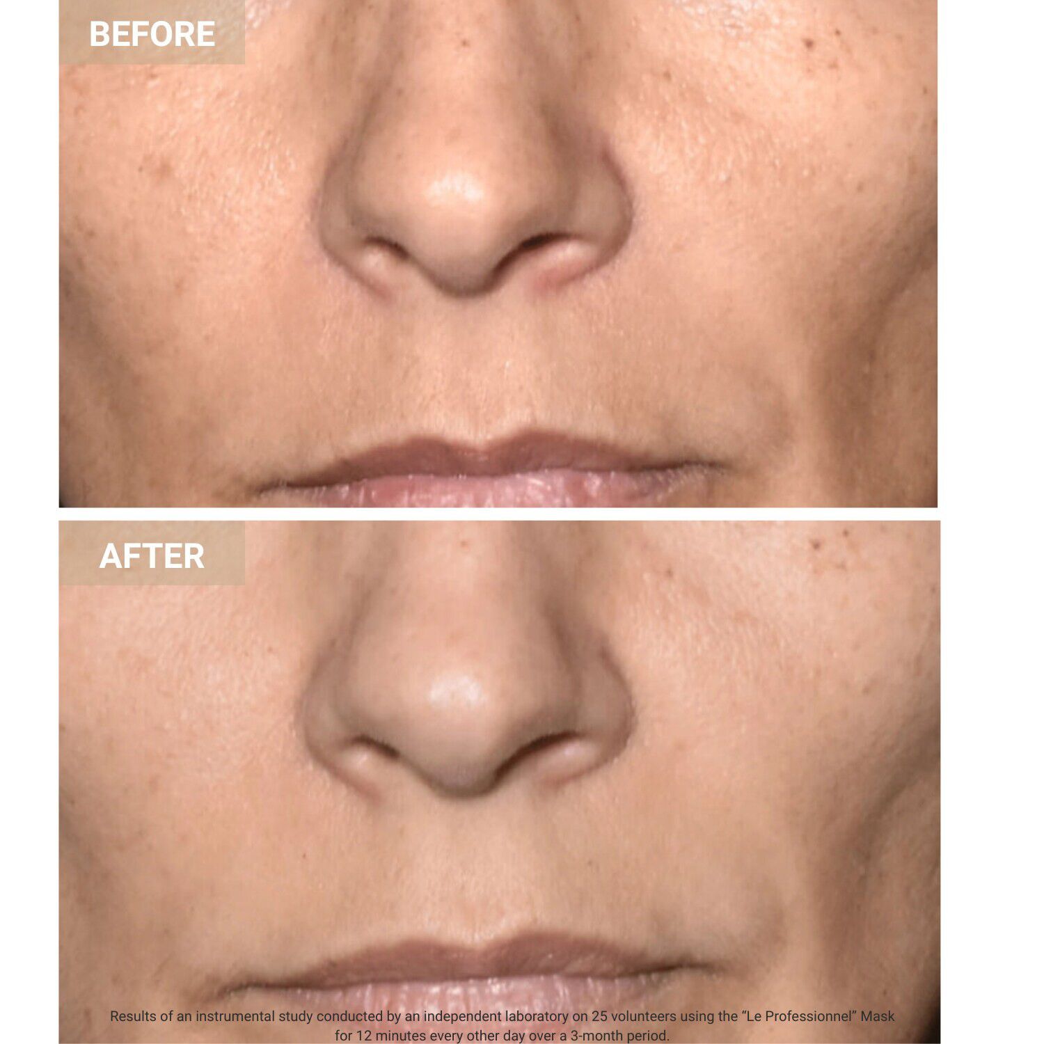 Anti-Aging LED Face Mask The Professional - Anti-age LED-ansigtsmaske