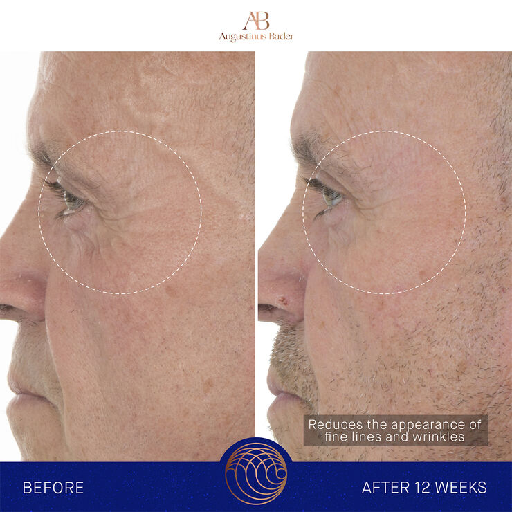 The Retinol Serum 15ml Nomade ROW