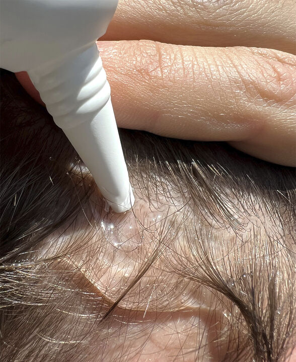 The Hair Growth Kit