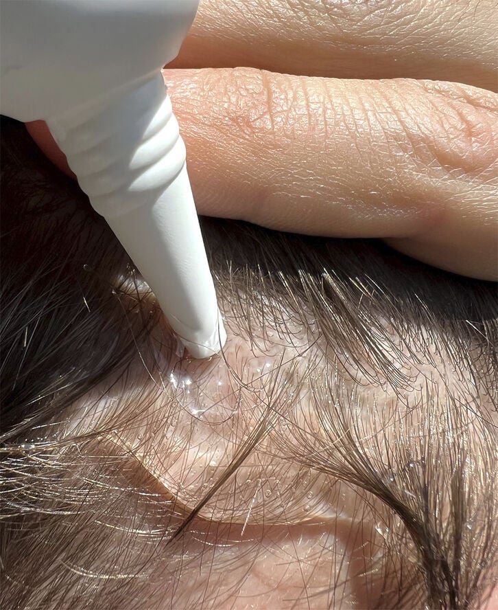 The Hair Growth Kit