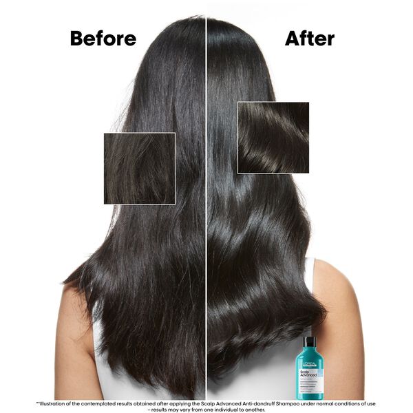 L'Oréal Professionnel Scalp Advanced Anti-Dandruff Shampoo 300ml