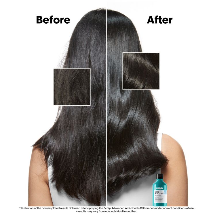 L'Oréal Professionnel Scalp Advanced Anti-Dandruff Shampoo 300ml