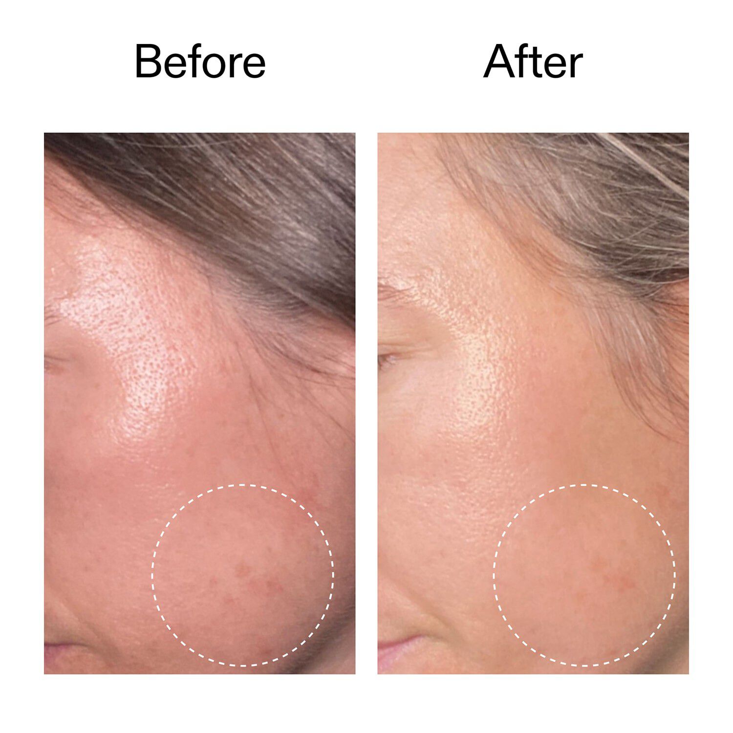 Advanced Retinal Serum - Avanceret retinalserum