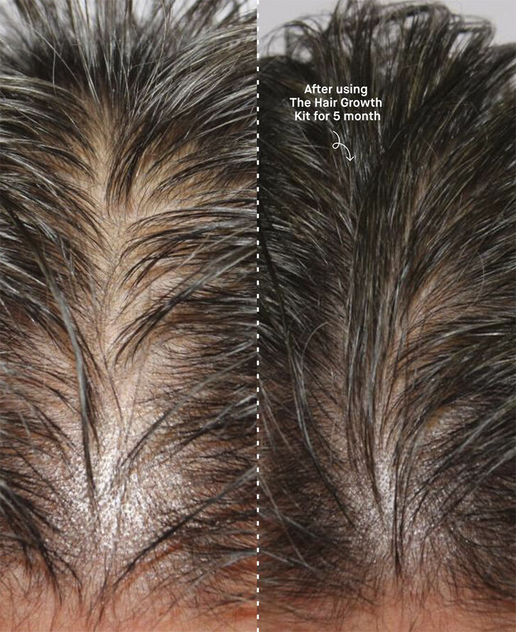 The Hair Growth Kit
