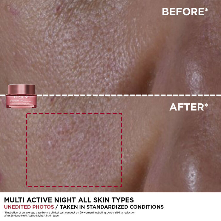Multi-Active Natcreme Normal/Dry skin