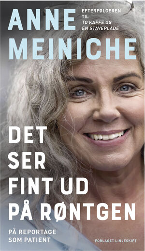 Det ser fint ud på røntgen